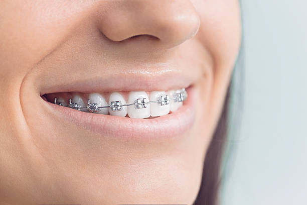 Best Dental Fillings (Composite and Amalgam)  in Morton, MS